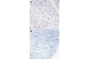 Immunohistochemical staining (Formalin-fixed paraffin-embedded sections) of human heart tissue with BLM (phospho T99) polyclonal antibody  without blocking peptide (A) or preincubated with blocking peptide (B) under 1:50-1:100 dilution. (BLM anticorps  (pThr99))