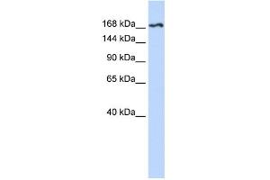 WB Suggested Anti-KDR Antibody Titration:  0. (VEGFR2/CD309 anticorps  (N-Term))