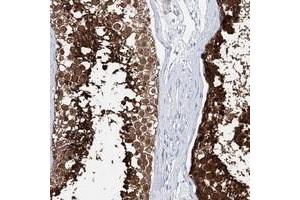 Immunohistochemical staining of human testis with C10orf53 polyclonal antibody  shows strong cytoplasmic positivity in cells in seminiferus ducts. (C10ORF53 anticorps)
