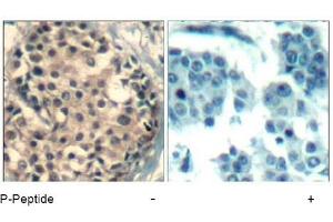 Image no. 2 for anti-HDAC4,HDAC5,HDAC9 (pSer220), (pSer246), (pSer259) antibody (ABIN319279) (HDAC4/HDAC5/HDAC9 anticorps  (pSer220, pSer246, pSer259))