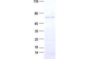 Validation with Western Blot