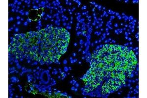 IF analysis of SYP using anti-SYP antibody (ABIN3042768). (Synaptophysin anticorps  (N-Term))