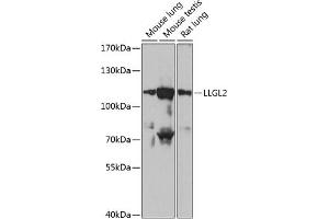 Western blot analysis of extracts of various cell lines, using LLGL2 antibody (ABIN6134714, ABIN6143260, ABIN6143263 and ABIN6217274) at 1:1000 dilution. (LLGL2 anticorps  (AA 900-1000))