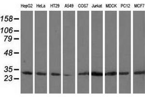 Western blot analysis of extracts (35 µg) from 9 different cell lines by using anti-CAPZA1 monoclonal antibody. (CAPZA1 anticorps)