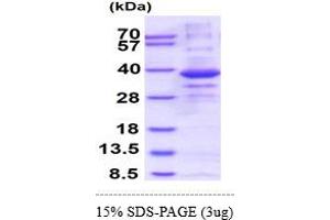 SDS-PAGE (SDS) image for Calcineurin-Like phosphoesterase Domain Containing 1 (Cpped1) (AA 1-314) protein (His tag) (ABIN5853023) (Cpped1 Protein (AA 1-314) (His tag))