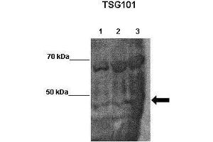 WB Suggested Anti-TSG101 Antibody    Positive Control:  Lane 1: 30ug mouse brain lysate  Lane 2: 30ug mouse brain lysate  Lane 3: 30ug mouse brain lysate   Primary Antibody Dilution :   1:1000  Secondary Antibody :  Goat anti-rabbit-HRP   Secondry Antibody Dilution :   1:50,000  Submitted by:  Teresa Gunn, McLaughin Research Institute