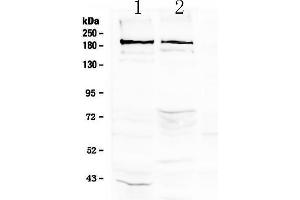 Western blot analysis of Neurocan using anti-Neurocan antibody . (Neurocan anticorps)