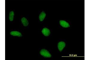Immunofluorescence of purified MaxPab antibody to FLJ10379 on HeLa cell. (SRBD1 anticorps  (AA 1-620))