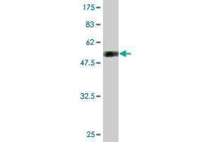 Western Blot detection against Immunogen (51. (TGIF2 anticorps  (AA 1-237))