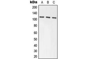 Western blot analysis of Axin-1 expression in HEK293T (A), NIH3T3 (B), PC12 (C) whole cell lysates. (Axin anticorps  (Center))
