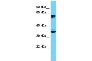 Host: Rabbit Target Name: ATF5 Sample Type: Hela Whole Cell lysates Antibody Dilution: 1.