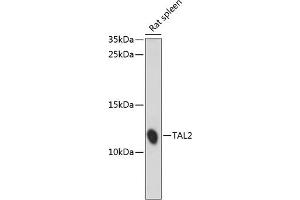 Western blot analysis of extracts of rat spleen, using T antibody (ABIN7270704) at 1:1000 dilution. (TAL2 anticorps  (C-Term))
