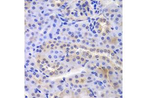 Immunohistochemistry of paraffin-embedded mouse kidney using PSMA6 antibody at dilution of 1:100 (400x lens). (PSMA6 anticorps)