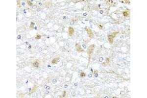 Immunohistochemistry of paraffin-embedded Rat brain using ATP2C1 Polyclonal Antibody at dilution of 1:100 (40x lens). (ATP2C1 anticorps)