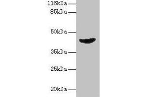 Western blot All lanes: ADA antibody at 2 μg/mL + Jurkat whole cell lysate Secondary Goat polyclonal to rabbit IgG at 1/10000 dilution Predicted band size: 41 kDa Observed band size: 41 kDa (ADA anticorps  (AA 157-343))