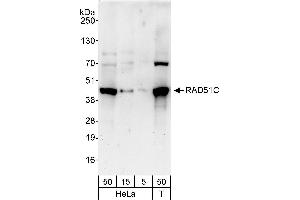 Western Blotting (WB) image for anti-DNA Repair Protein RAD51 Homolog 3 (RAD51C) (AA 326-376) antibody (ABIN7453176)