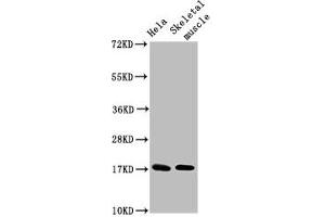 Western Blot Positive WB detected in: Hela whole cell lysate, Rat skeletal muscle tissue All lanes: UBE2D3 antibody at 4. (UBE2D3 anticorps  (AA 1-147))