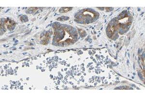 ABIN6274956 at 1/100 staining Human prostate tissue by IHC-P.