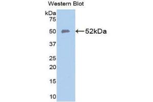 Western Blotting (WB) image for anti-Solute Carrier Family 40 (Iron-Regulated Transporter), Member 1 (SLC40A1) (AA 127-321) antibody (ABIN1111115)