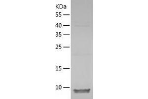 Western Blotting (WB) image for Chemokine (C-C Motif) Ligand 27 (CCL27) (AA 25-112) protein (His tag) (ABIN7122293)