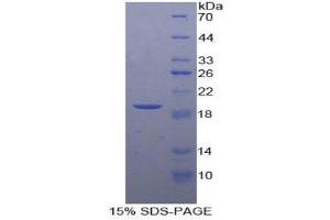 SDS-PAGE (SDS) image for Adrenomedullin (ADM) (AA 31-187) protein (His tag) (ABIN1879861)