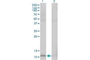 Western Blot analysis of HSPE1 expression in transfected 293T cell line by HSPE1 monoclonal antibody (M01), clone 4C11-B11.