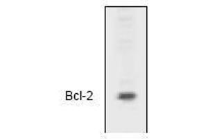 Image no. 1 for anti-B-Cell CLL/lymphoma 2 (BCL2) (N-Term) antibody (ABIN126981) (Bcl-2 anticorps  (N-Term))
