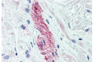 Image no. 3 for anti-Nestin (NES) antibody (ABIN108568) (Nestin anticorps)
