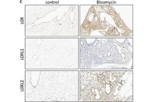 LOX/L expression in experimental lung fibrosis.