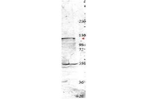 Western blot using  affinity purified anti-Nedd4 antibody shows detection of a 115 kDa band corresponding to endogenous Nedd4 (arrowhead) in MDA-MB-435S cell lysates. (NEDD4 anticorps  (Internal Region))