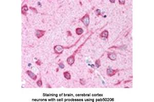 Image no. 1 for anti-Microtubule-Associated Protein 1 Light Chain 3 alpha (MAP1LC3A) (AA 1-100), (N-Term) antibody (ABIN363515)