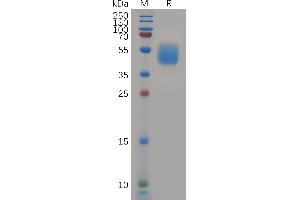 Human Protein, hFc Tag on SDS-PAGE under reducing condition.