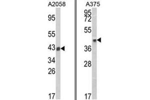 (LEFT) Western blot analysis of HLA-B Antibody (N-term) in A2058 cell line lysates (35ug/lane). (HLA B7 anticorps  (N-Term))