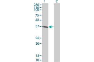 Western Blot analysis of SPI1 expression in transfected 293T cell line by SPI1 monoclonal antibody (M01), clone 1A3. (SPI1 anticorps  (AA 1-120))