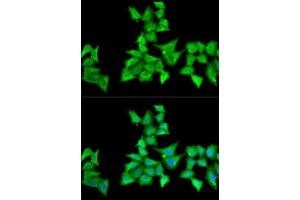 Immunofluorescence analysis of A549 cells using HAPLN1 antibody.