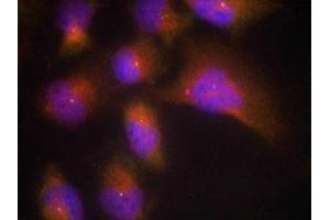 Immunofluorescence staining of methanol-fixed Hela cells using TrkB(Phospho-Tyr515) Antibody.