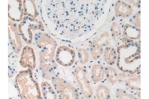 Detection of HMGB1 in Human Kidney Tissue using Polyclonal Antibody to High Mobility Group Protein 1 (HMGB1)