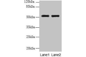 Western blot All lanes: WDR88 antibody at 6 μg/mL Lane 1: MCF-7 whole cell lysate Lane 2: A549 whole cell lysate Secondary Goat polyclonal to rabbit IgG at 1/10000 dilution Predicted band size: 53, 48 kDa Observed band size: 53 kDa (WDR88 anticorps  (AA 1-250))
