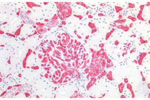 Immunohistochemistry staining of human kidney (paraffin-embedded sections) with anti-blood group A (HE-193), dilution 1:50. (ABO, Blood Group A Antigen anticorps)