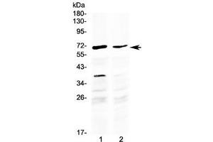 Western blot testing of human 1) HepG2 and 2) MCF7 cell lysate with MAK antibody at 0. (MAK anticorps  (AA 588-623))