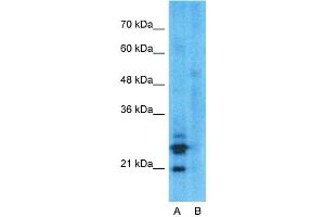 Host:  Rabbit  Target Name:  MUC1  Sample Type:  HepG2  Lane A:  Primary Antibody  Lane B:  Primary Antibody + Blocking Peptide  Primary Antibody Concentration:  1ug/ml  Peptide Concentration:  5ug/ml  Lysate Quantity:  25ug/lane/lane  Gel Concentration:  0.
