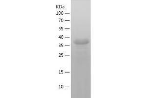 Western Blotting (WB) image for Synaptophysin (SYP) (AA 217-313) protein (His-IF2DI Tag) (ABIN7125269)