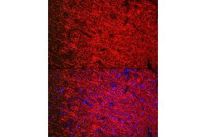 Immunofluorescence analysis of mouse brain cells using [KO Validated] βIII-Tubulin Mouse mAb  at dilution of 1:200 (40x lens). (TUBB3 anticorps)