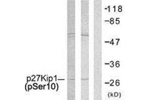 Western blot analysis of extracts from A2780 and COLO205 cells, using p27 Kip1 (Phospho-Ser10) Antibody. (CDKN1B anticorps  (pSer10))