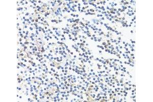 Immunohistochemistry of paraffin-embedded tonsil using HLA-DRB3 Polyclonal Antibody at dilution of 1:100 (40x lens). (HLA-DRB3 anticorps)