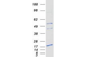 Validation with Western Blot