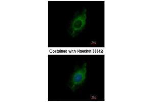 ICC/IF Image Immunofluorescence analysis of methanol-fixed HeLa, using Kinesin 5A, antibody at 1:500 dilution.