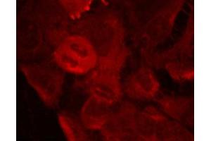 Immunofluorescence staining of methanol-fixed Hela cells using MEK-2(Phospho-Thr394) Antibody.