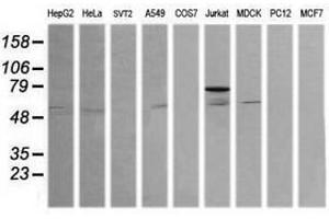 Image no. 4 for anti-ERG, ETS transcription factor (ERG) antibody (ABIN1498075) (ERG anticorps)