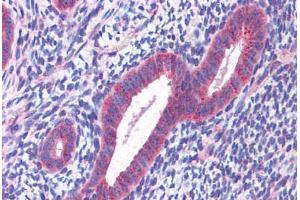 Human Uterus: Formalin-Fixed, Paraffin-Embedded (FFPE) (CCDC106 anticorps  (C-Term))